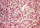 Hantavírus: conheça sintomas, formas de transmissão e como se prevenir da doença