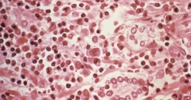 Hantavírus: conheça sintomas, formas de transmissão e como se prevenir da doença