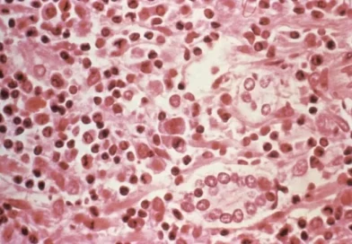 Hantavírus: conheça sintomas, formas de transmissão e como se prevenir da doença