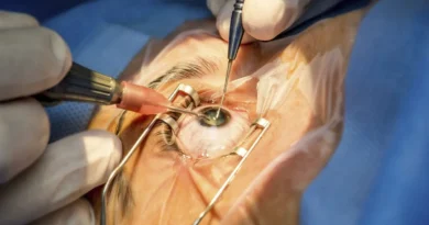 Mutirão disponibiliza 1,4 mil vagas para avaliação e cirurgia de catarata em Teresina